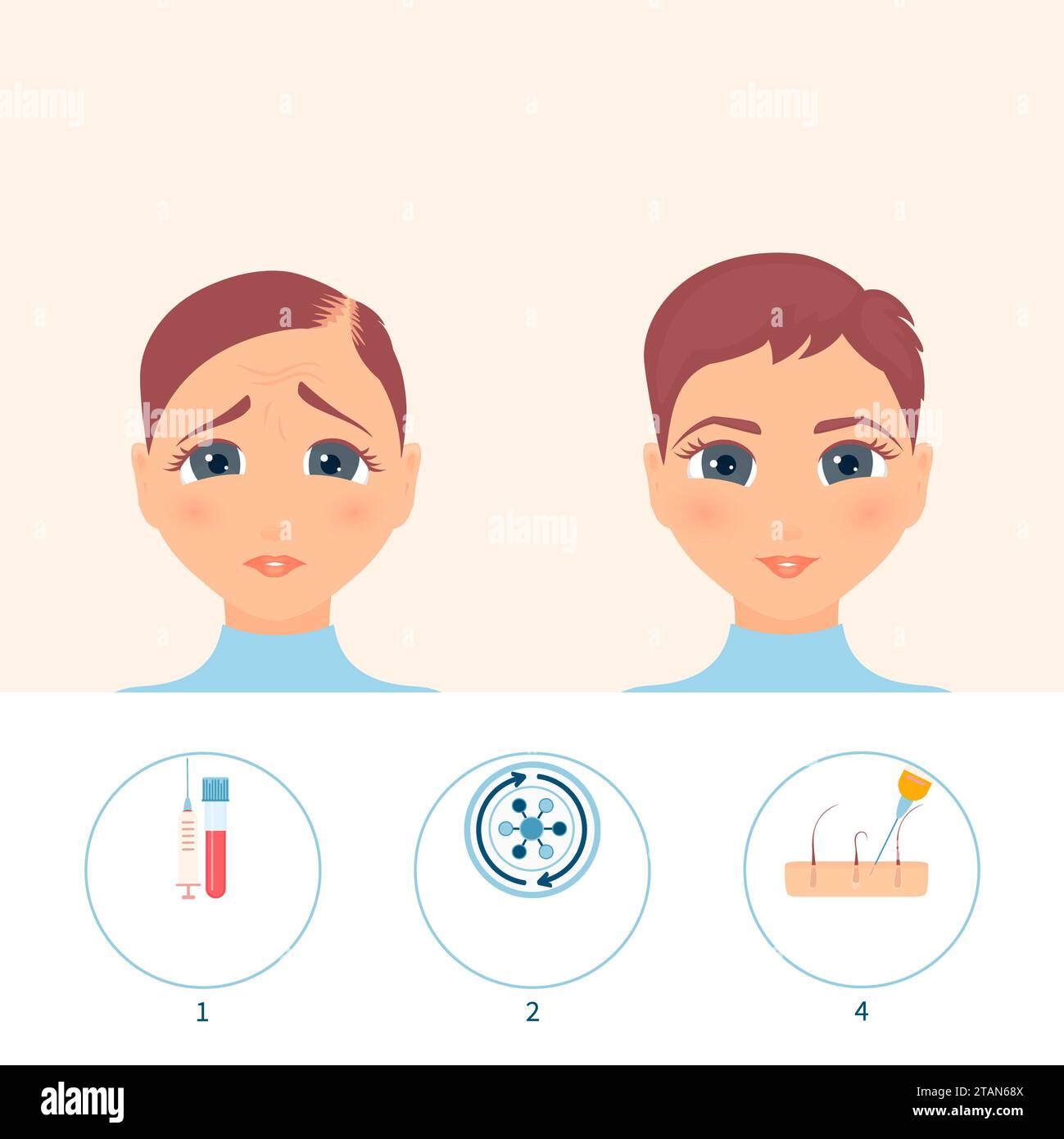 PRP hair treatment, conceptual illustration Stock Photo