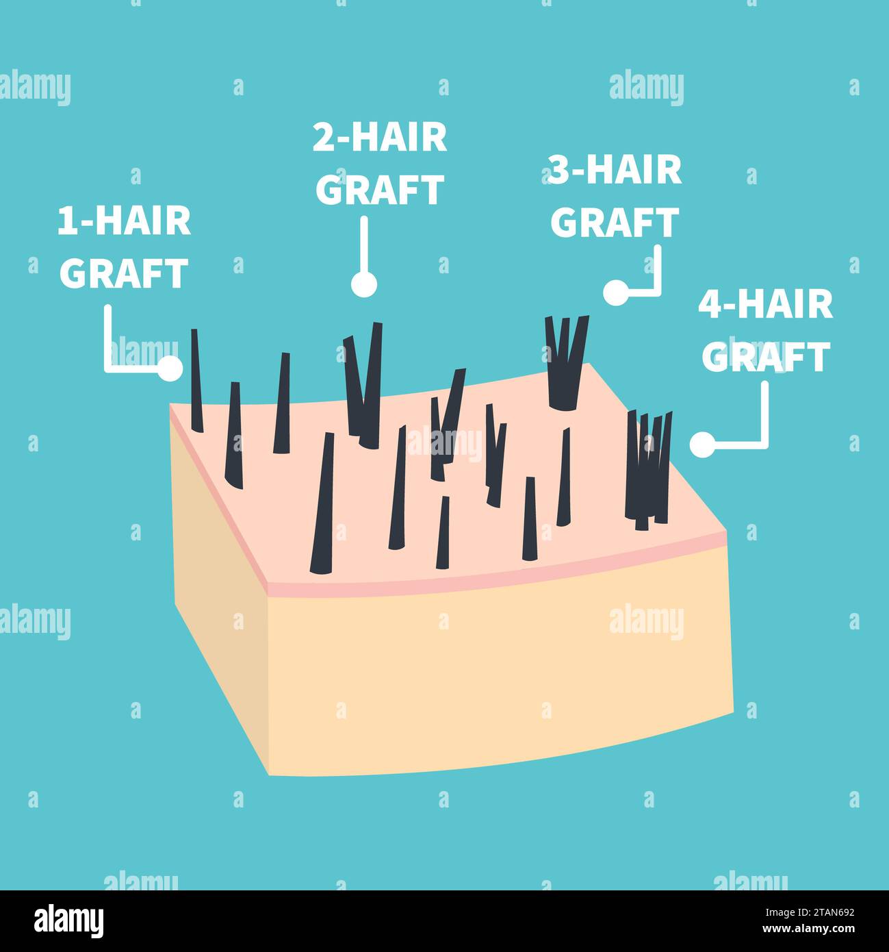 Human hair, conceptual illustration Stock Photo Alamy