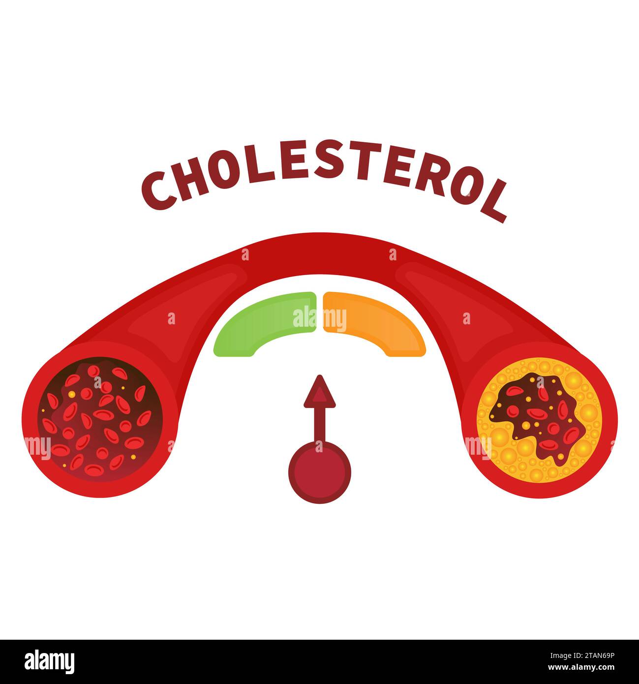 Cholesterol levels, conceptual illustration Stock Photo