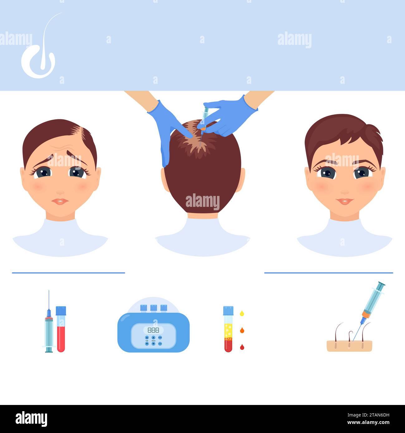 PRP for hair loss treatment, conceptual illustration Stock Photo