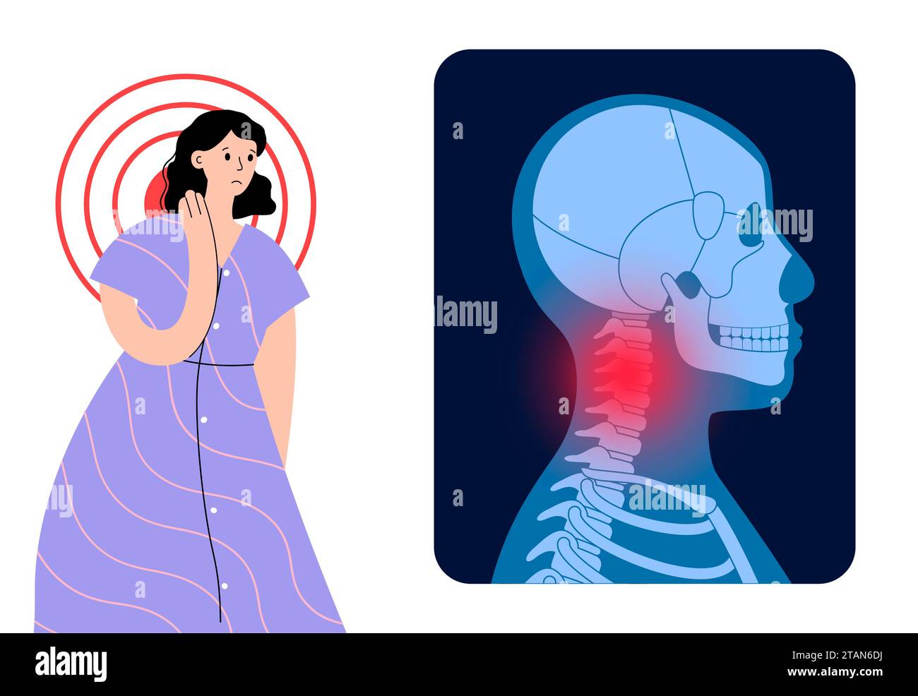 Neck pain, conceptual illustration Stock Photo Alamy