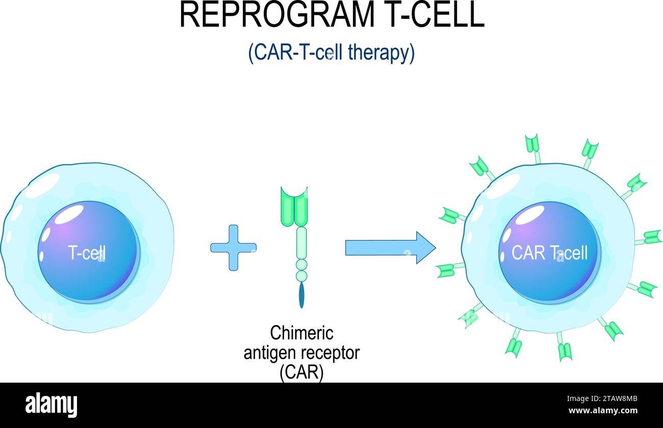 CAR-T-cell cancer therapy. Process of a T cell reprogramming. Immunotherapy of a Chimeric Antigen Receptor CAR. Cancer treatment. Genetic engineering. Stock Vector