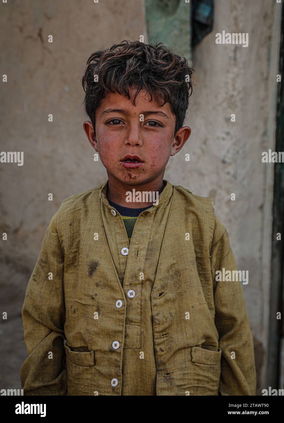 A homeless Afghan refugee boy in need of assistance | Needy Afghan refugee boy in a difficult situation | Needy Afghan refugee boy seeking help. Stock Photo