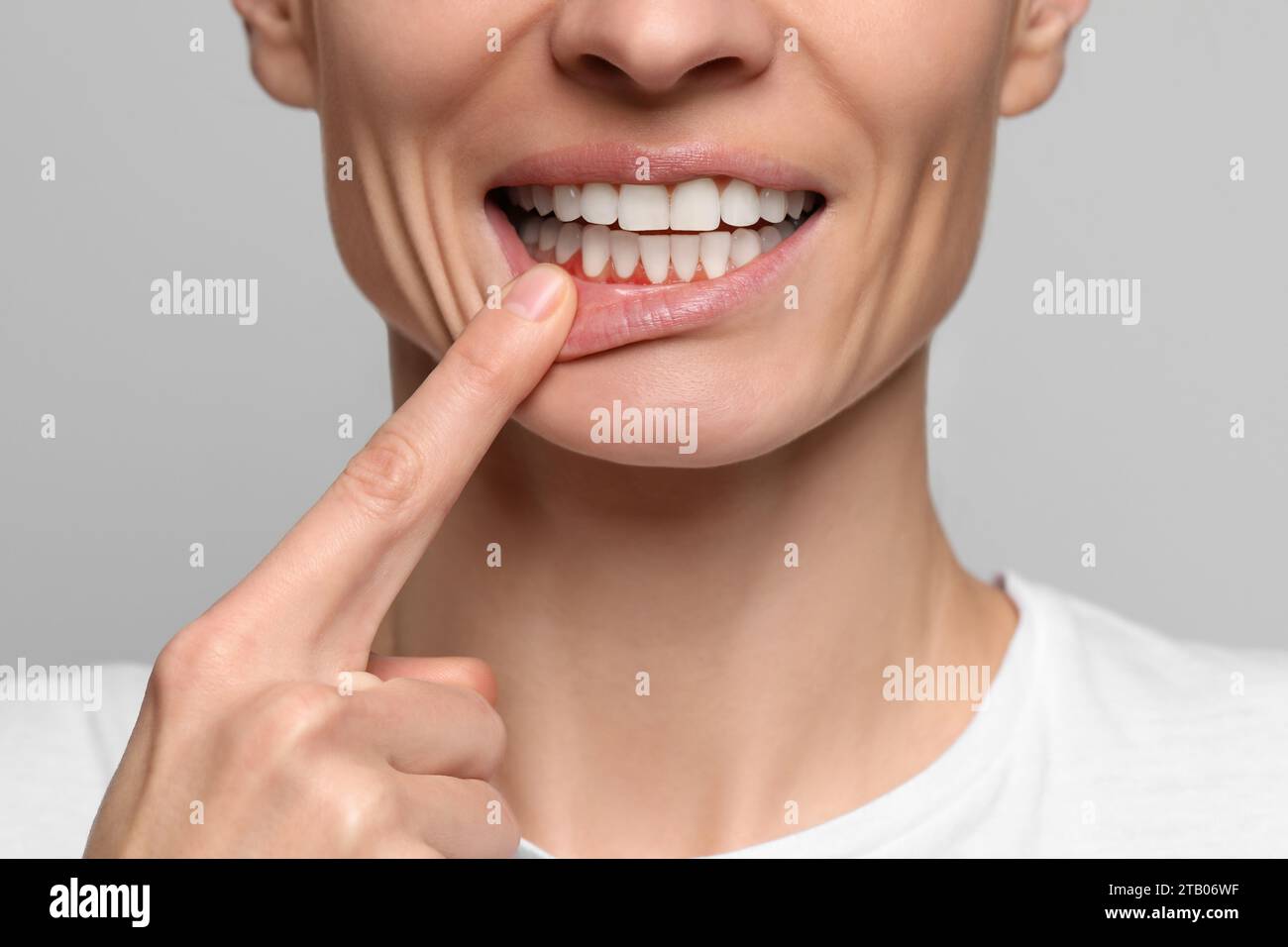 Woman showing inflamed gum on grey background, closeup Stock Photo