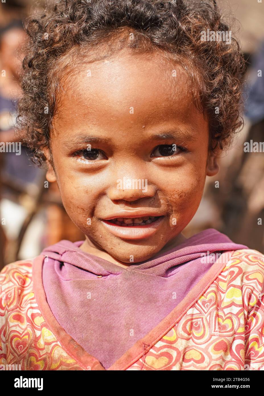 Behenjy, Madagascar - April 25, 2019: Small local girl in dirty clothes donated by tourists looking into camera. People in Madagascar, especially Mala Stock Photo