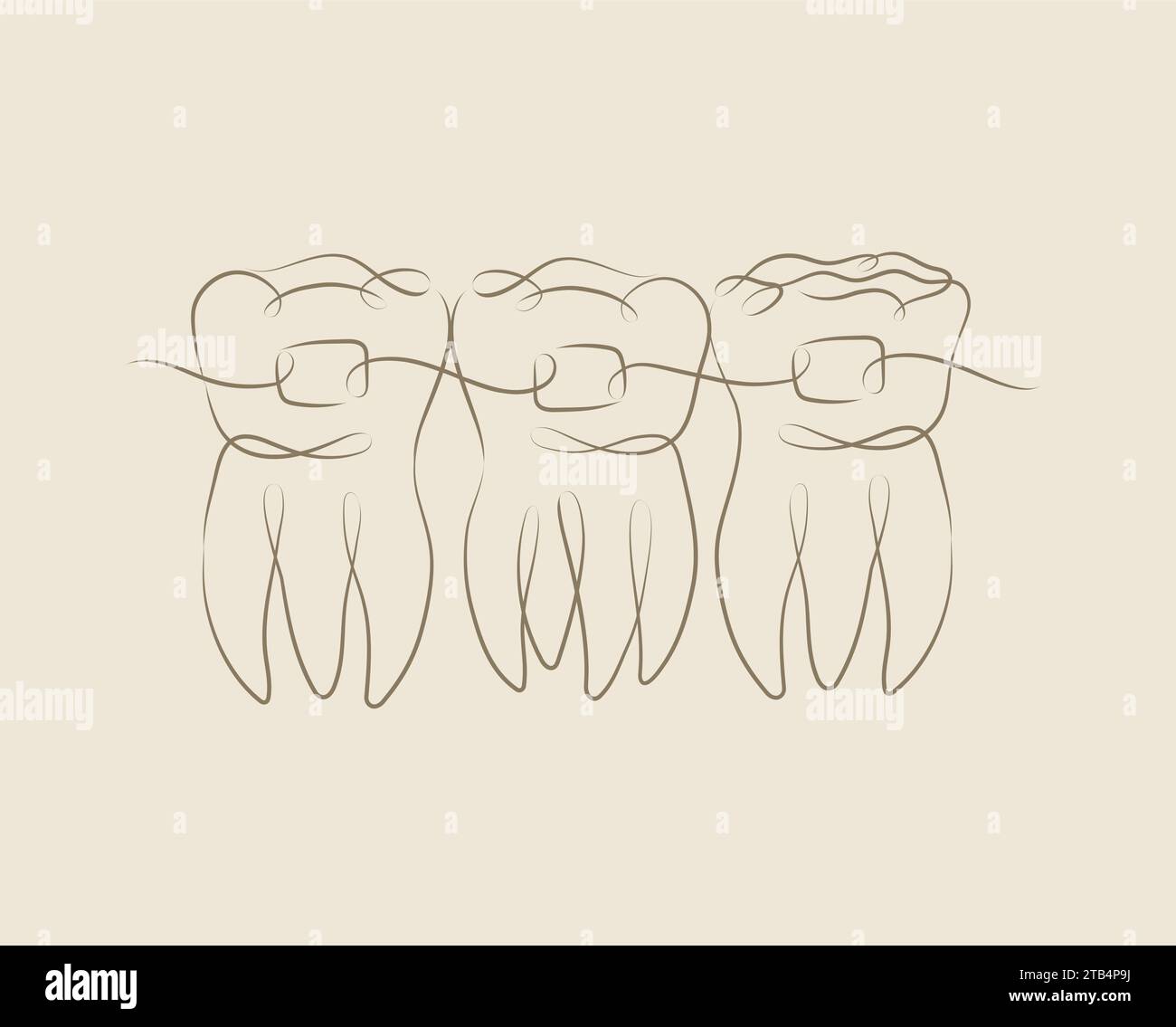 Teeth with braces illustration drawing in linear style on beige