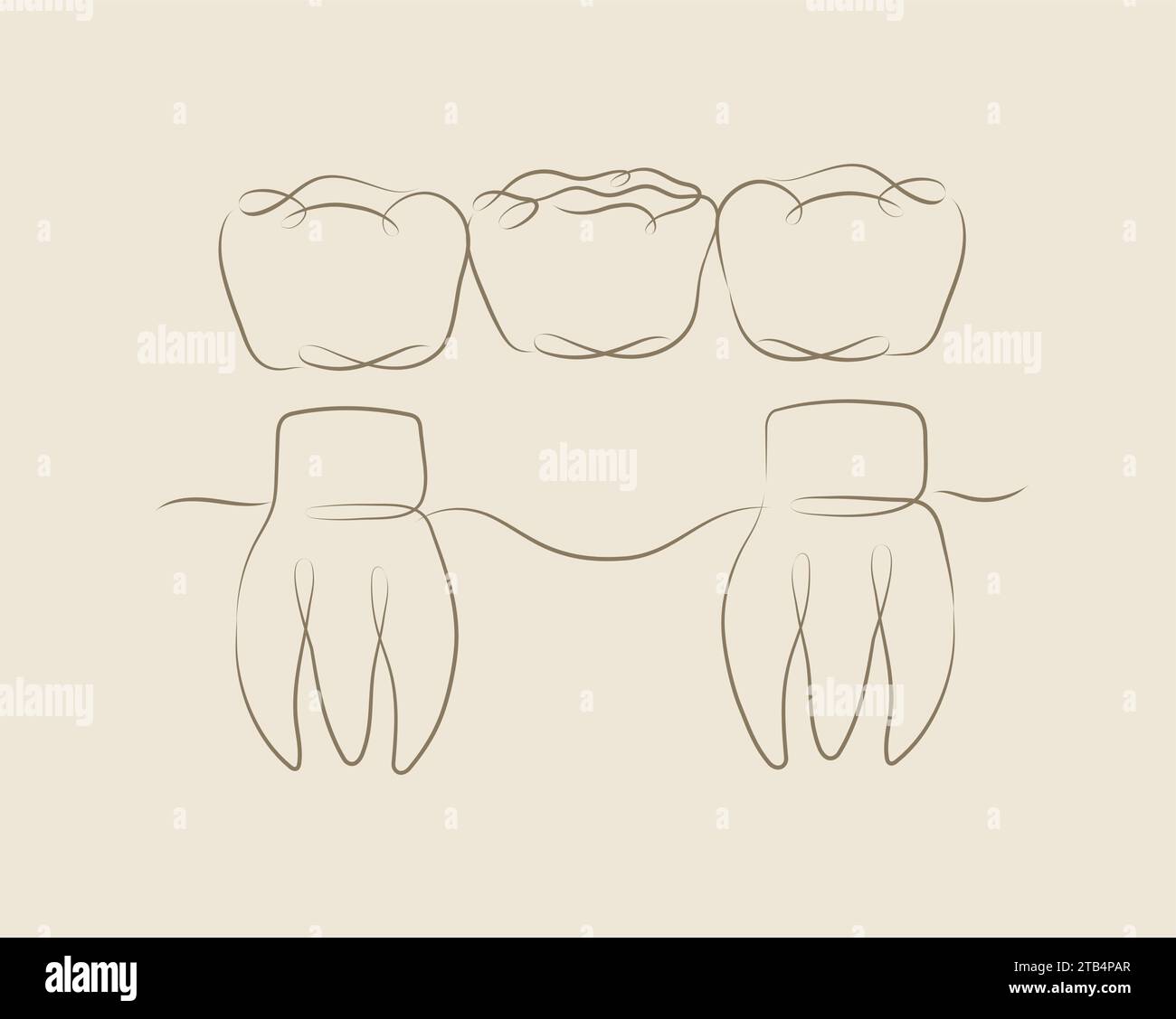Tooth Queen Drawing Teeth with crown bridge illustration drawing in linear style on beige ...