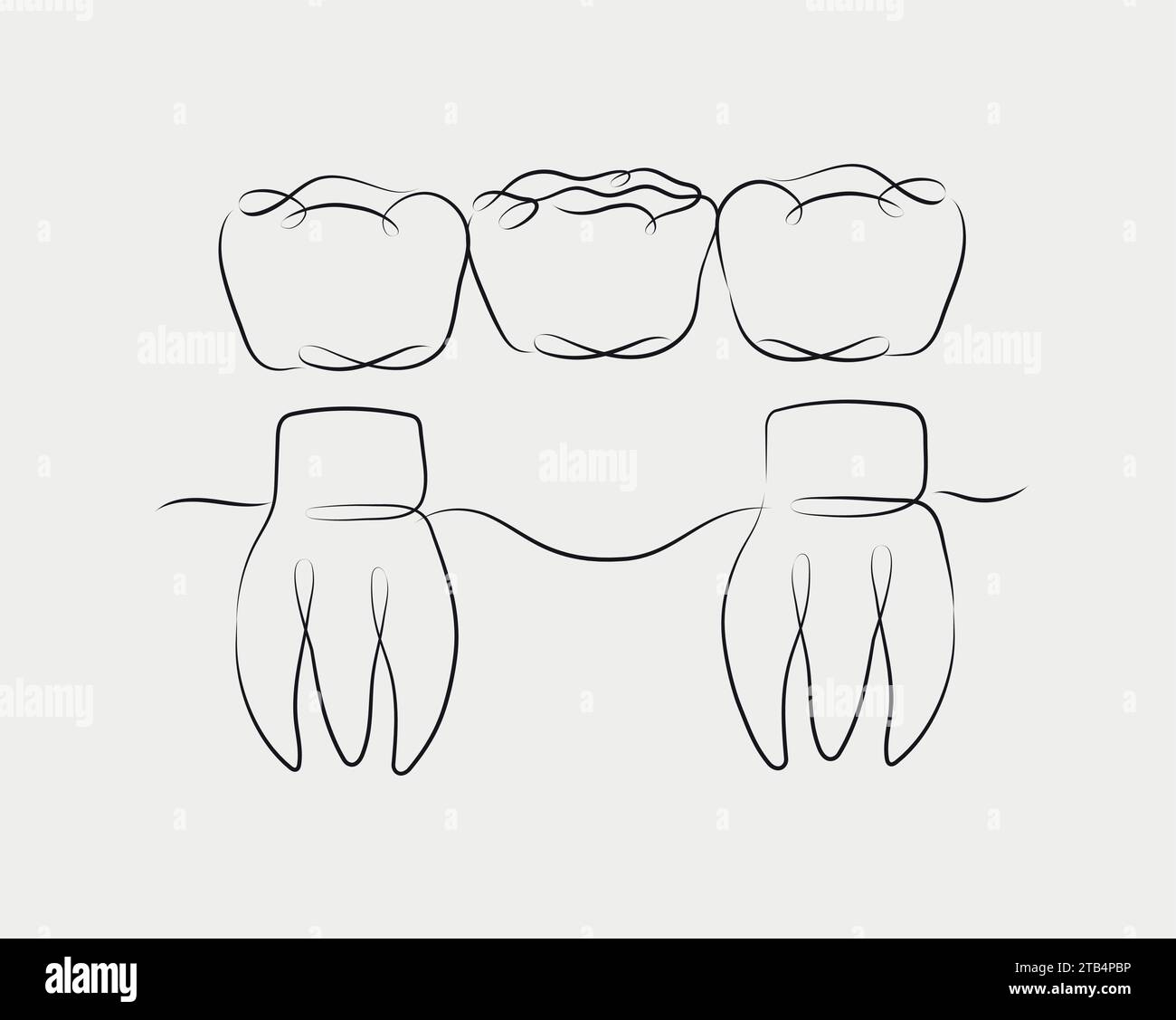 Teeth with crown bridge illustration drawing in linear style on white