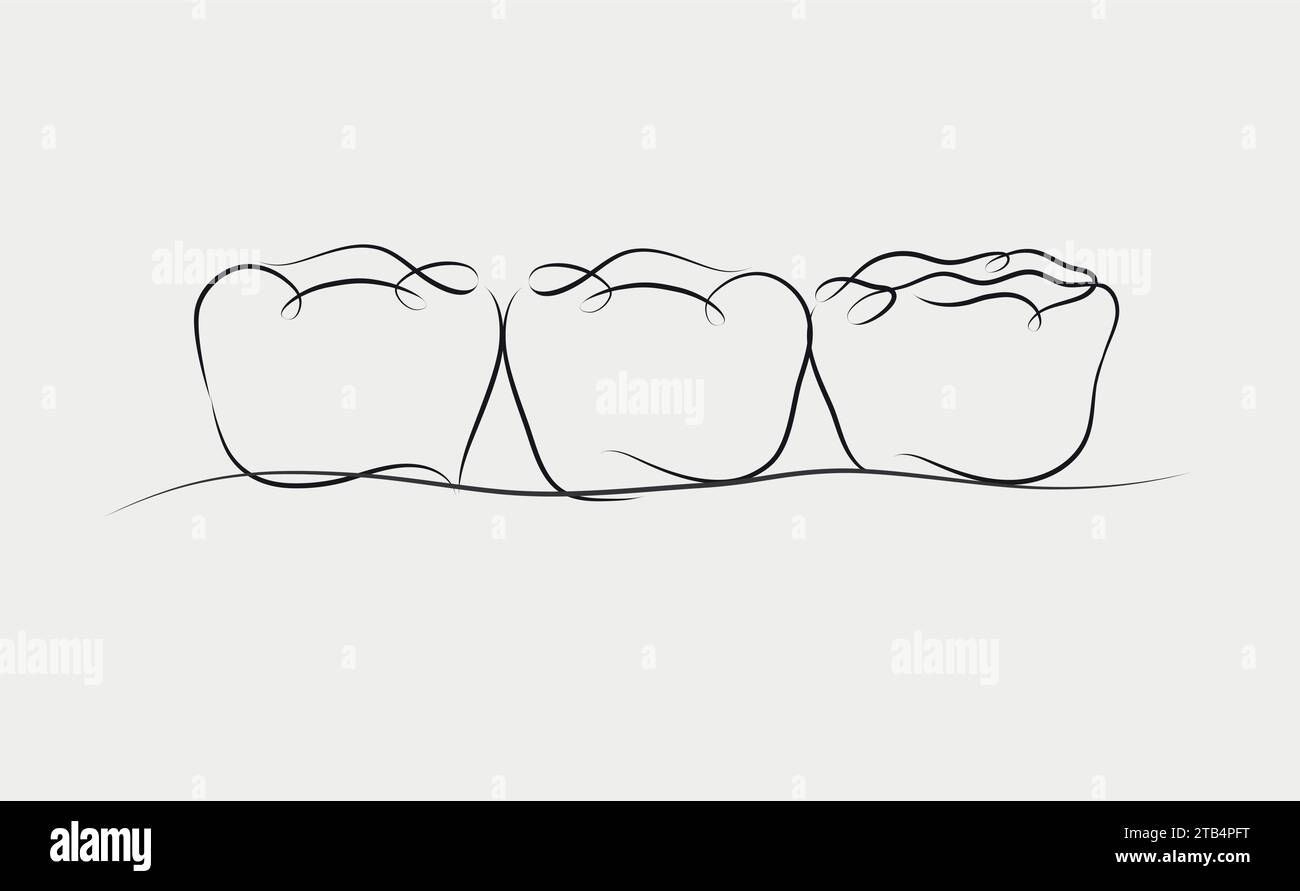 Implanted teeth with crown bridge illustration drawing in linear style