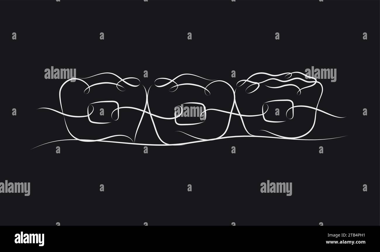 Teeth braces illustration drawing in linear style on black color