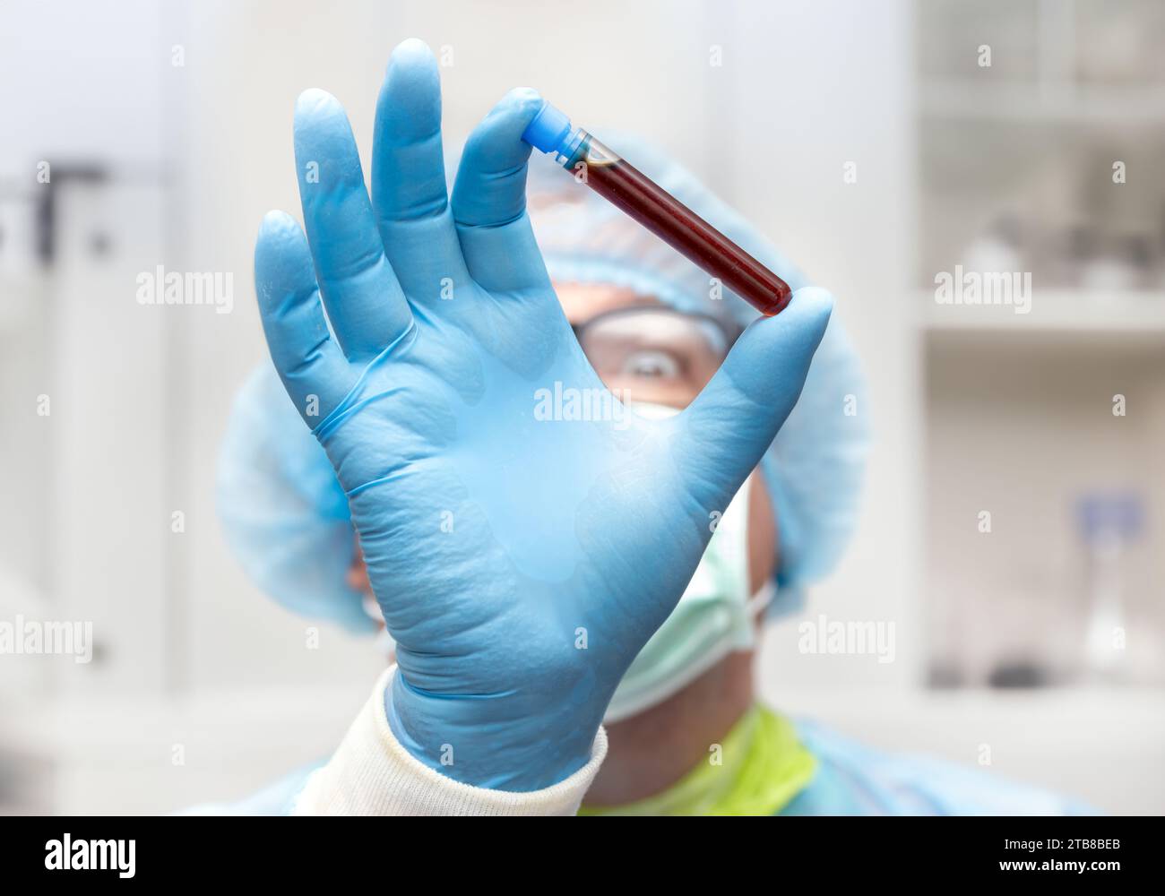 The doctor hold test tube with a testing blood, focus on a hand