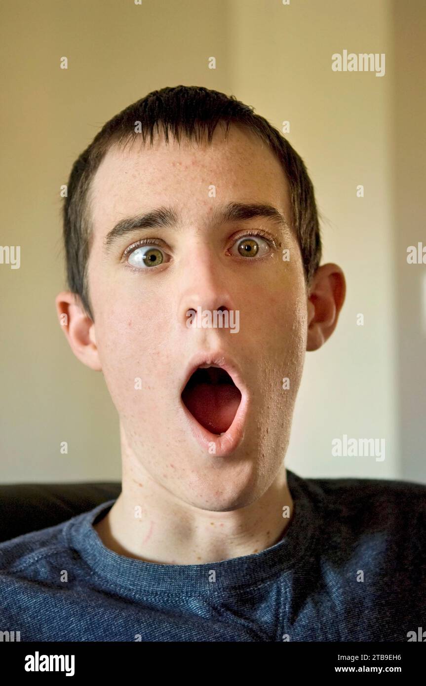 Teenage boy makes a goofy face; Lincoln, Nebraska, United States of America Stock Photo