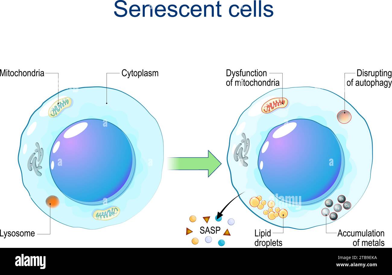 Senescent cells. Cellular senescence from Dysfunction of mitochondria, accumulation of metals, Disrupting of autophagy, Lipid droplets to release Stock Vector