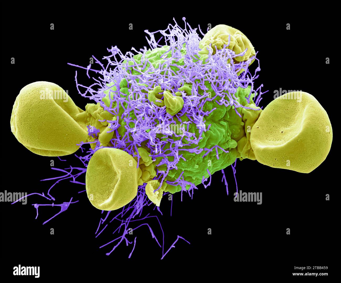 Respiratory Syncytial Virus, SEM Stock Photo