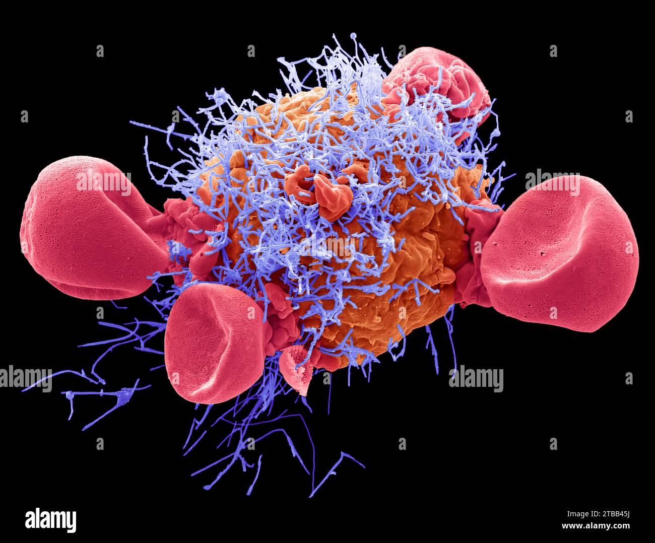 Respiratory Syncytial Virus, SEM Stock Photo
