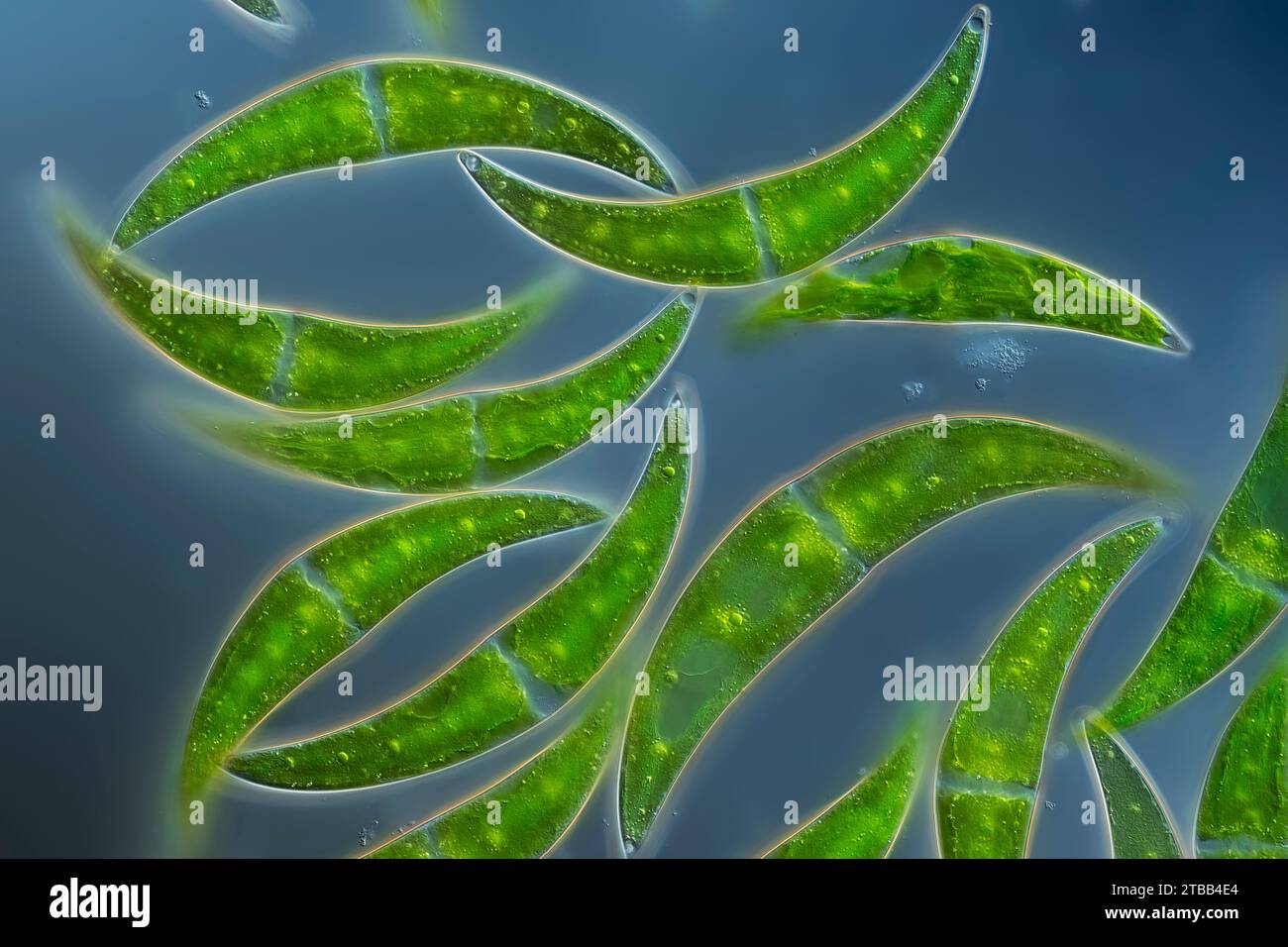 Closterium algae, light micrograph Stock Photo - Alamy