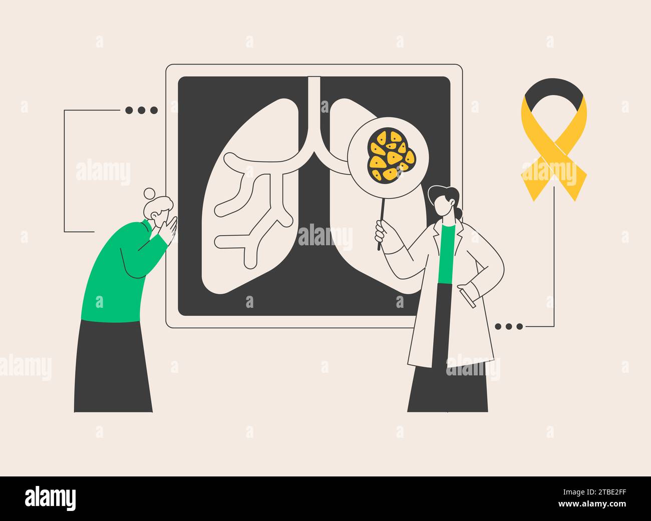 Lung cancer abstract concept vector illustration Stock Vector Image ...