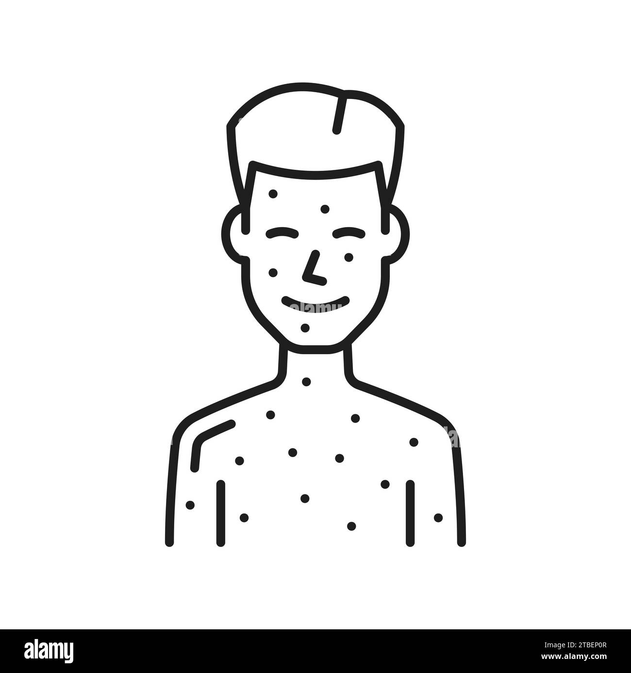 Baby boy with skin rash, hives, irritation or chickenpox measles