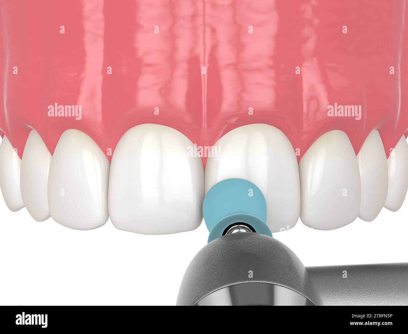 3d render of diastema closure using bonding procedure. Part 8 polishing tooth by rubber cup
