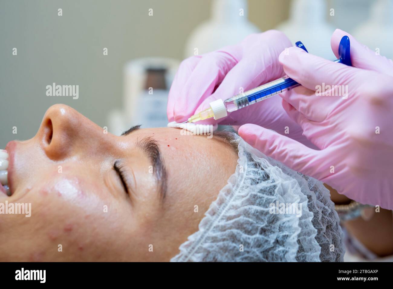 Face injections to woman with skin problems, beauty treatment in ...