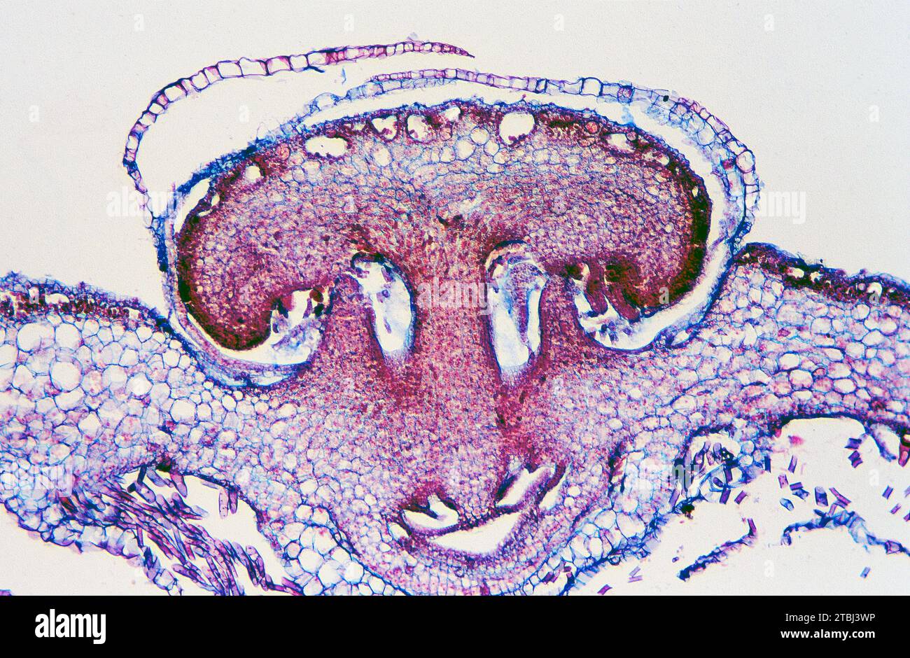 Marchantia archegonium  micrograph. Archegonium contain female gametophytes. Magnification X40. Stock Photo