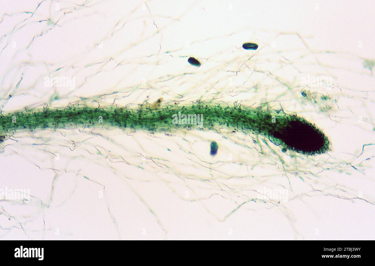 The calyptra or root cap protect growing tip in plants. Optical microscope, magnification X40. Stock Photo