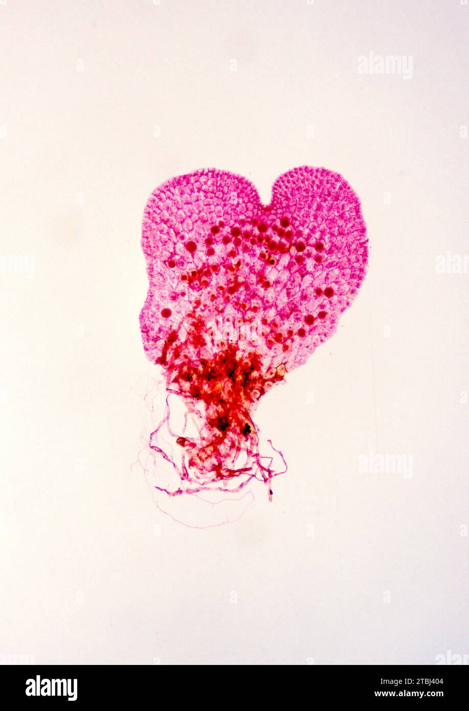 Fern prothallus with rhizoids. Optical microscope, magnification X15. Stock Photo