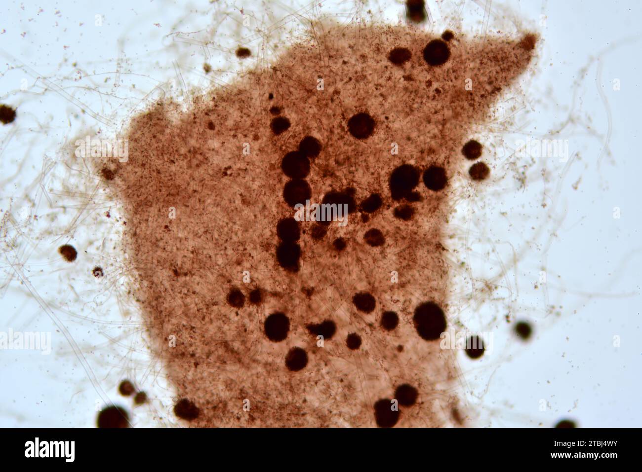Conidia and conidiophores of fungus ascomycetes. Optical microcope X100. Stock Photo