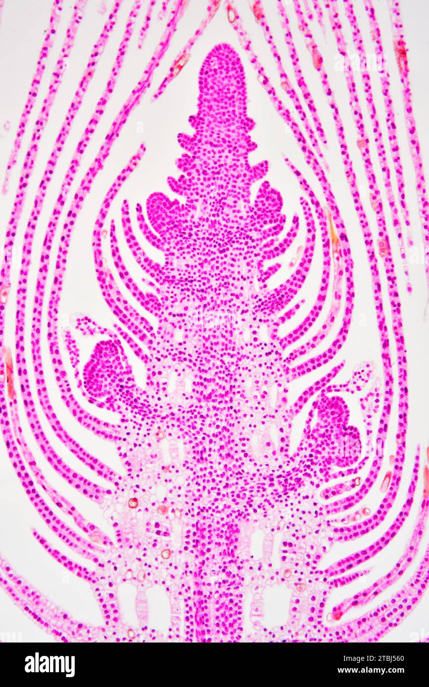 Elodea apical meristem. Optical microscope X100. Stock Photo