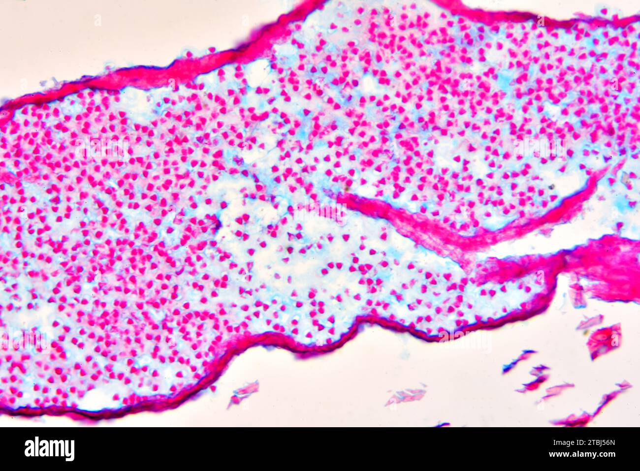 Moss spores (Polytrichum). Optical microscope X200. Stock Photo
