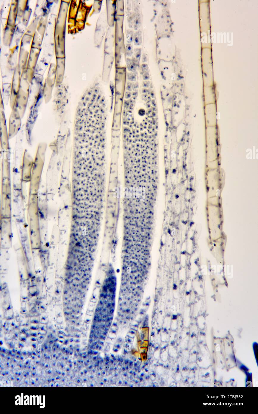 Archegonium of moss. Optical microscope X200 Stock Photo - Alamy