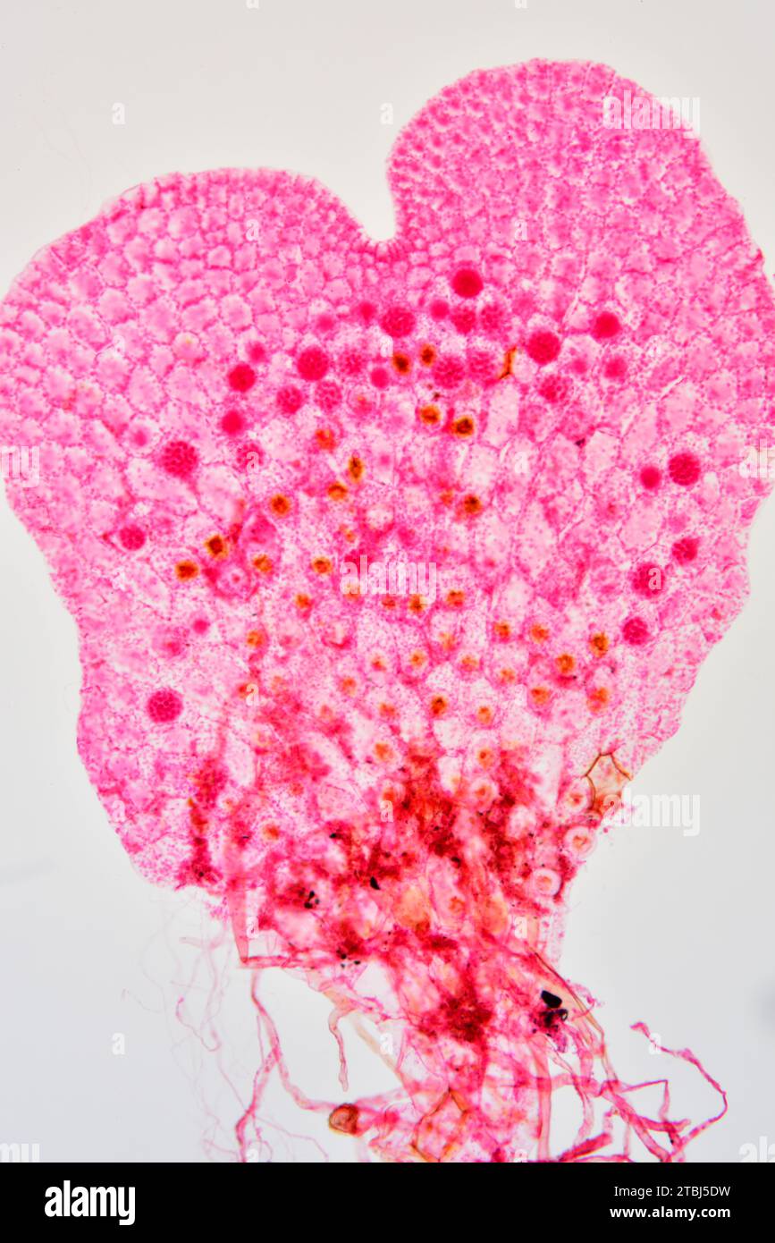 Fern prothallus or prothallium with rizoids. Optical microscope X100. Stock Photo