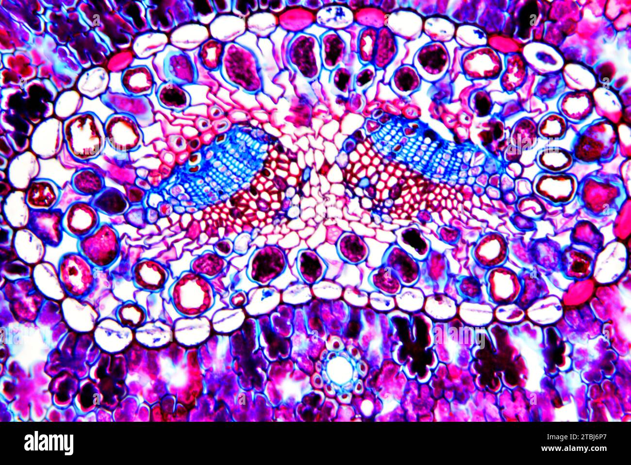 Leaf cross section of pine (Pinus sp.) showing endodermis, mesophyll