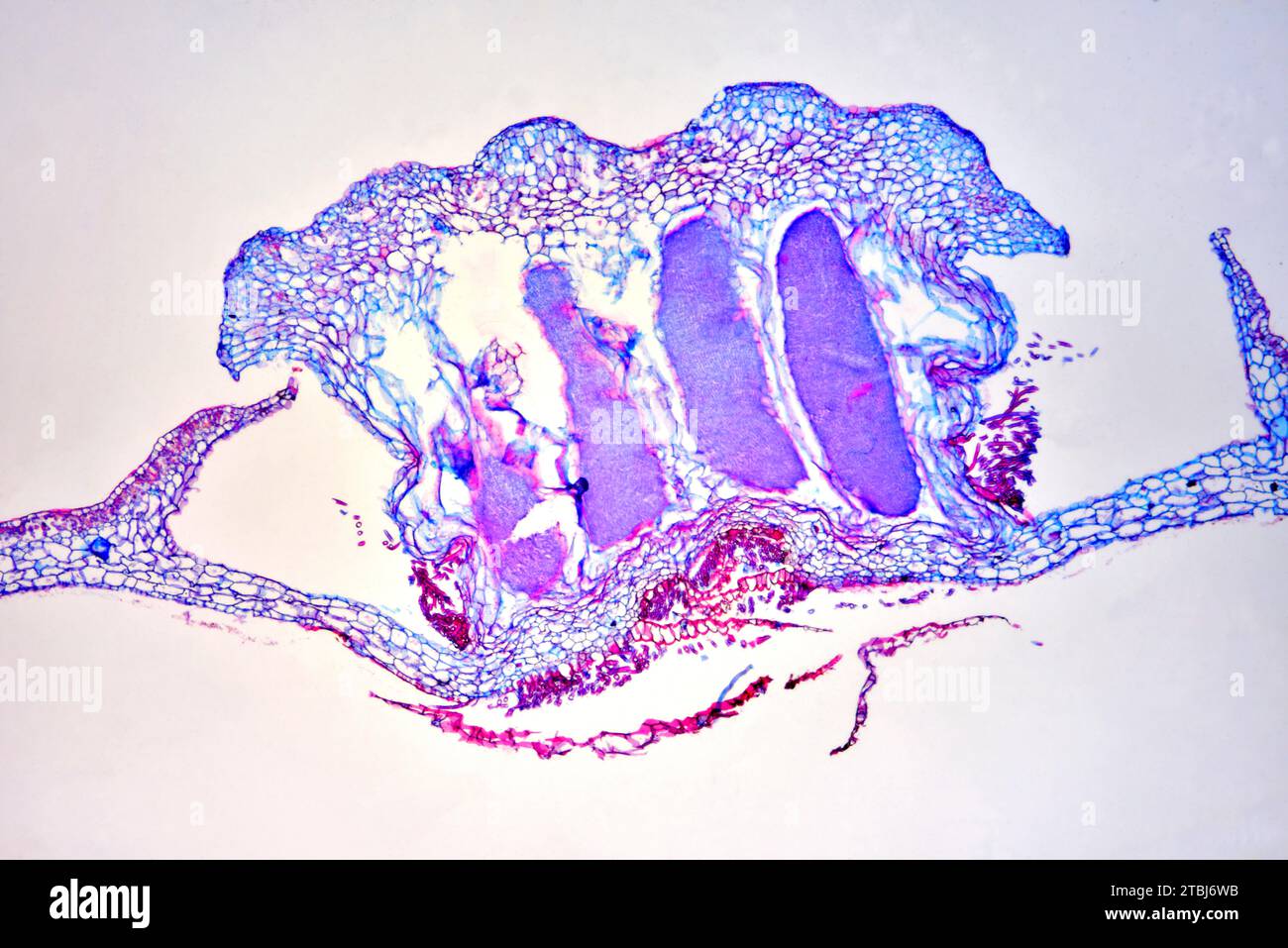 Antheridium of Marchantia sp. a liverwort. Optical microscope X 40. Stock Photo