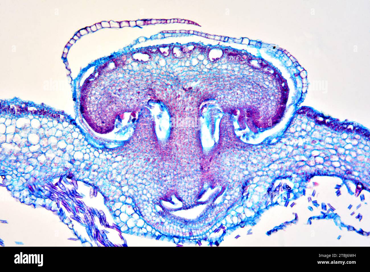 Archegonium of Marchantia sp. a liverwort. Optical microscope X100. Stock Photo