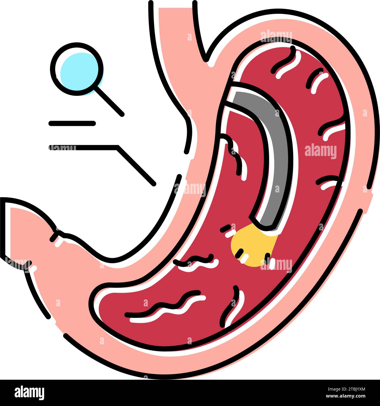 William Stern Gastroenterologist