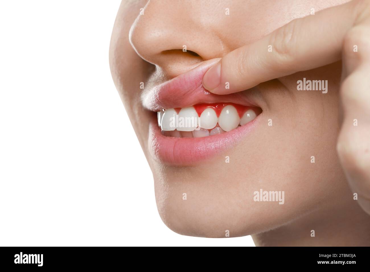 Woman showing inflamed gum on white background, closeup Stock Photo