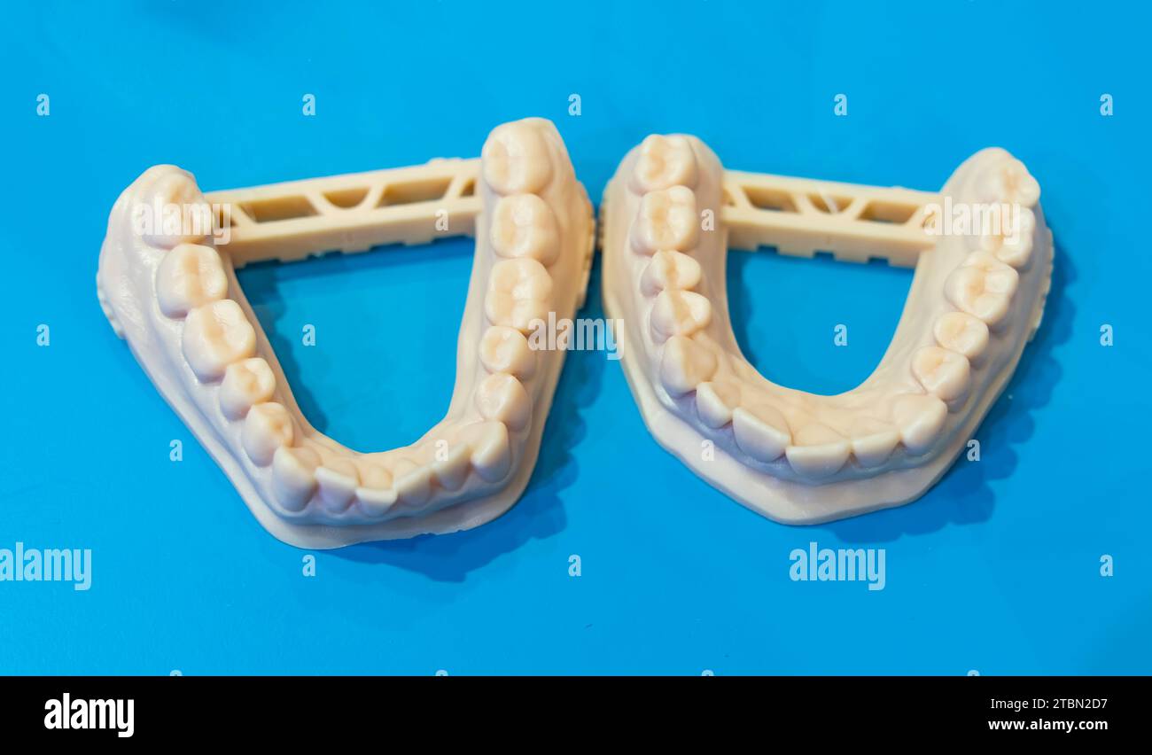 lower jaw of a man created on a 3d printer Stock Photo