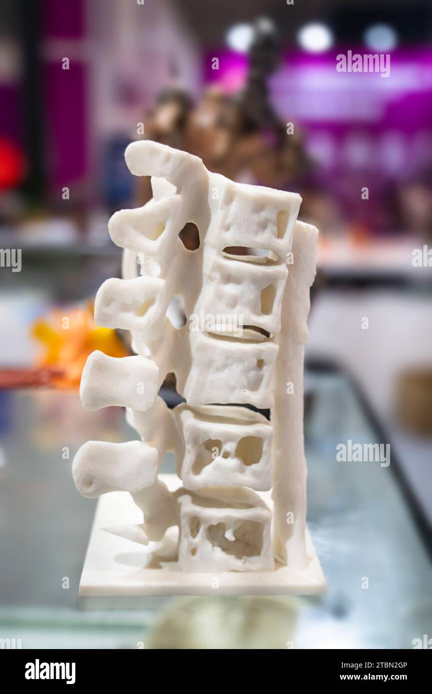 3d printed human spine in 3d printer. Stock Photo