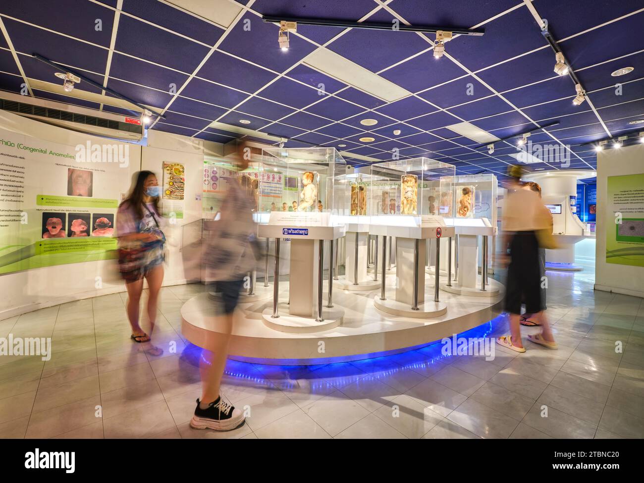 A room filled with human, child specimens of congenital anomalies. At