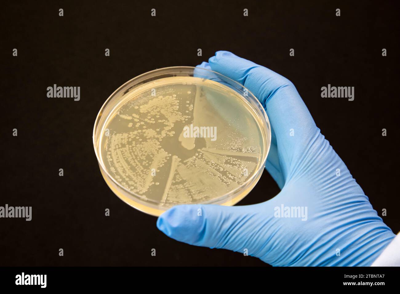 Streaking of an aqar plate to produce a single colony Stock Photo