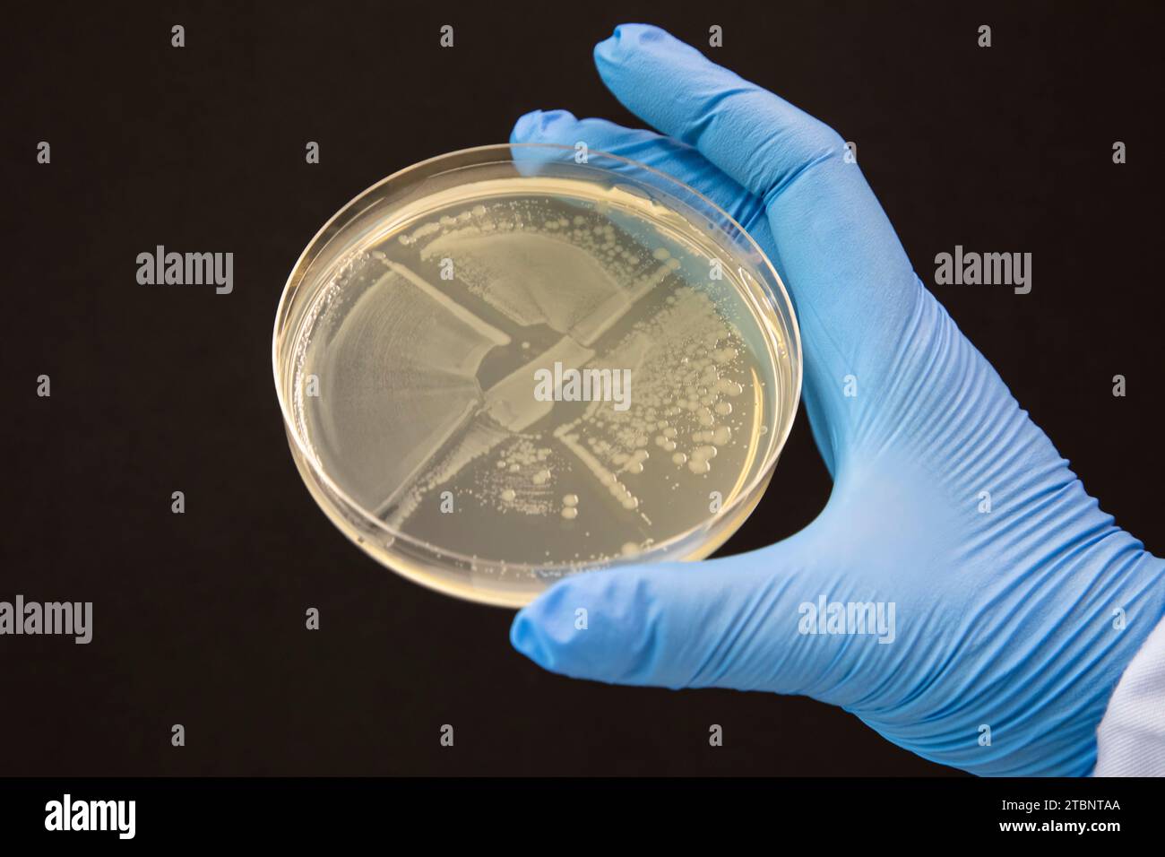 Streaking of an aqar plate to produce a single colony Stock Photo