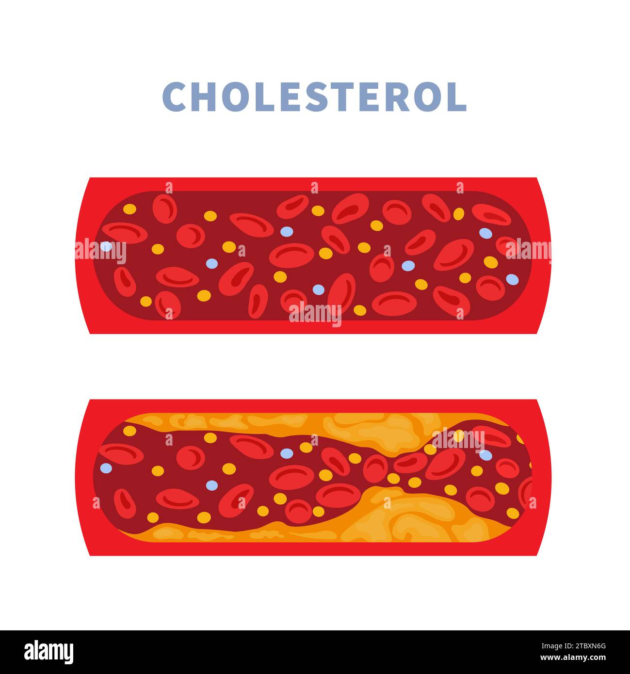 Artery health, conceptual illustration Stock Photo