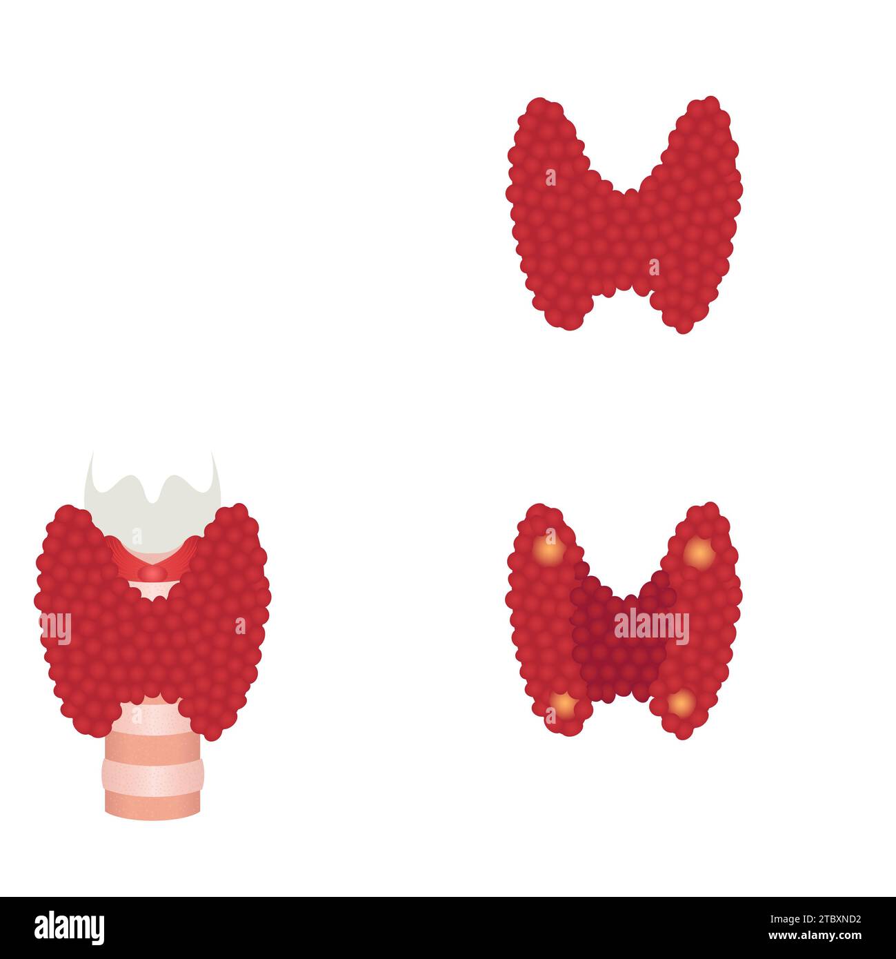 Thyroid gland conceptual illustration Stock Photo Alamy