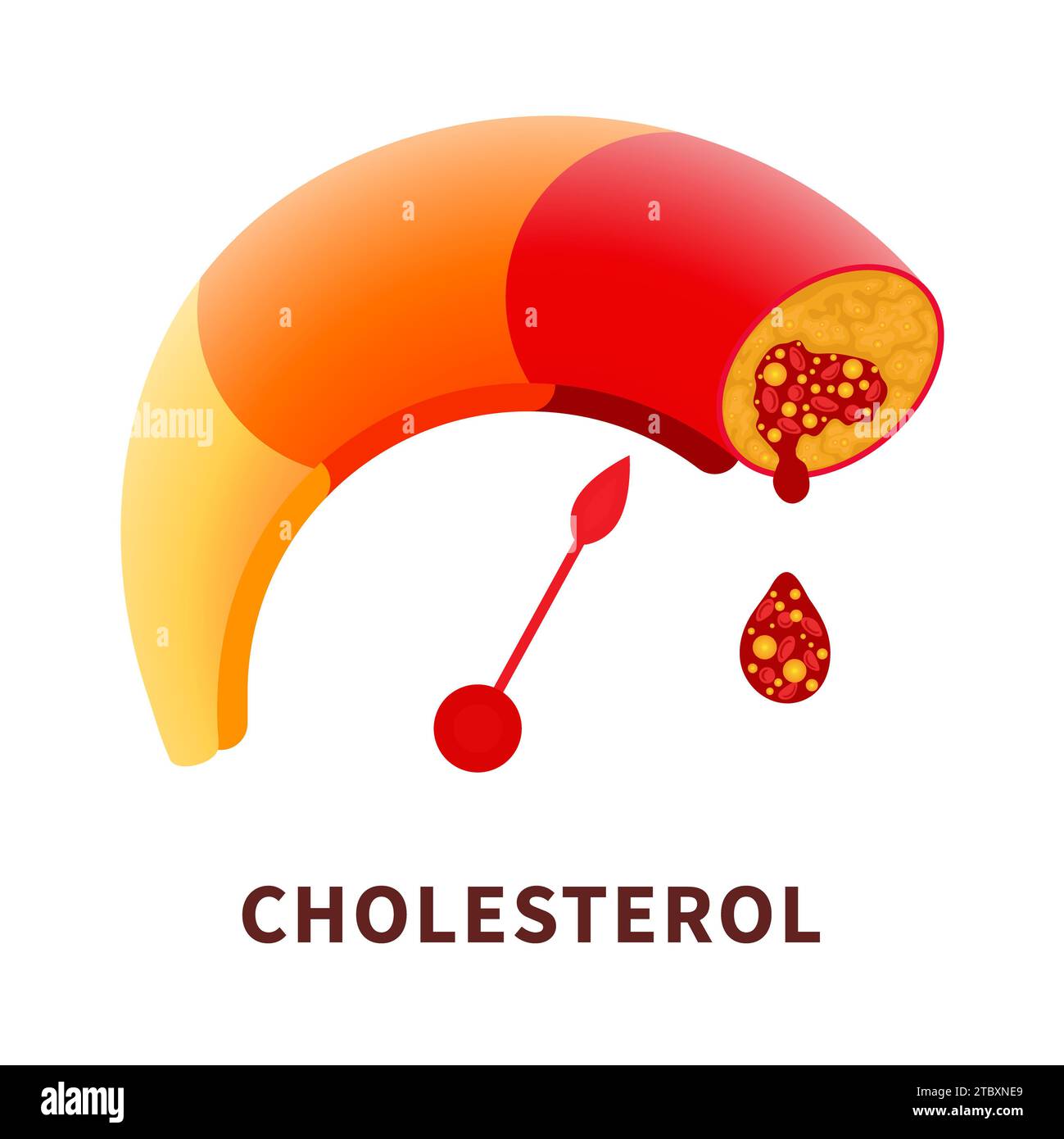 Atherosclerosis, conceptual illustration Stock Photo
