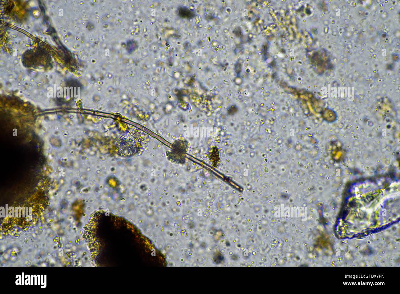 soil microbes under the microscope. microorganisms with fungus in ...