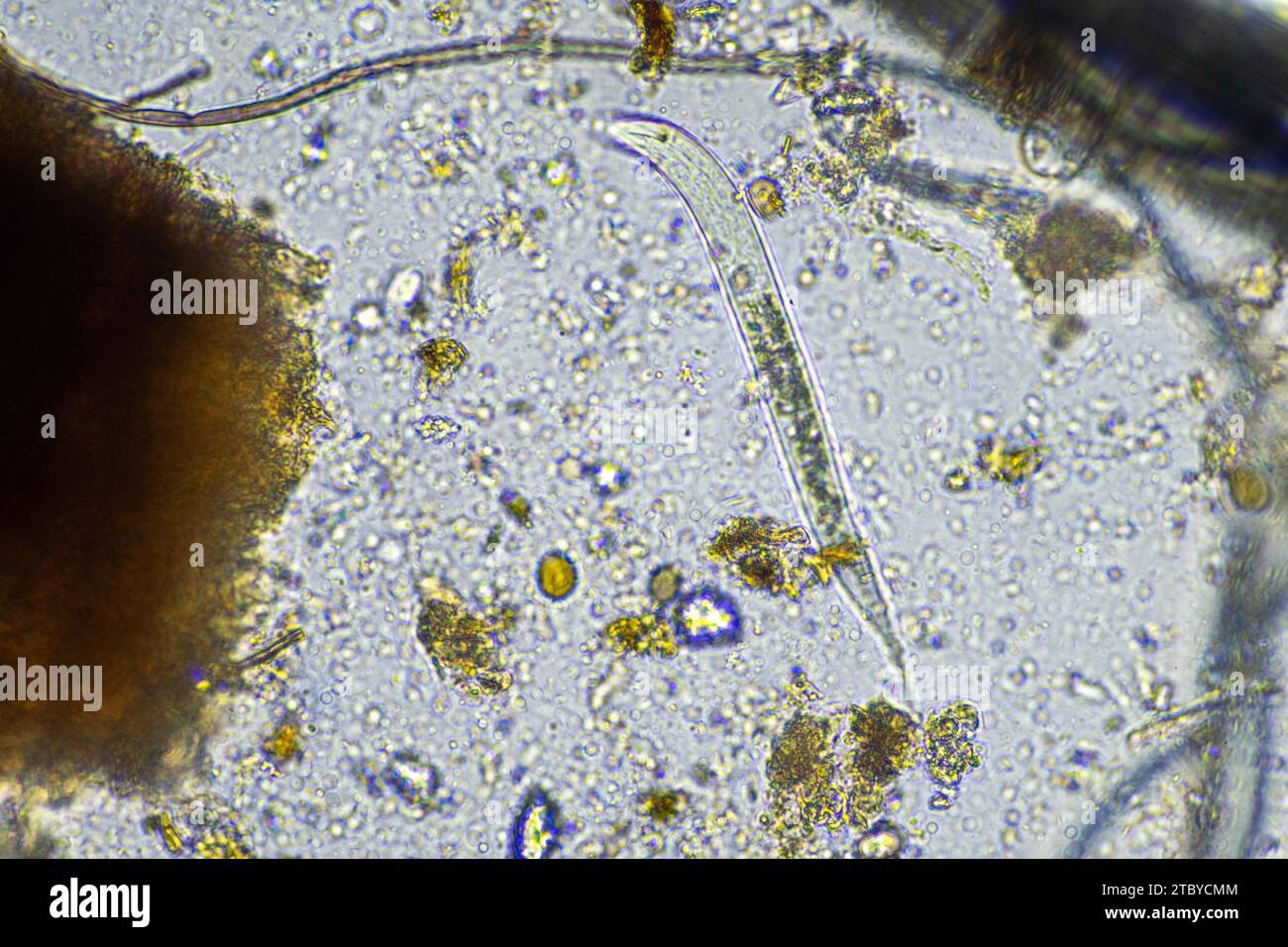 microscopic fungus and microorganisms in a sample in australia Stock Photo