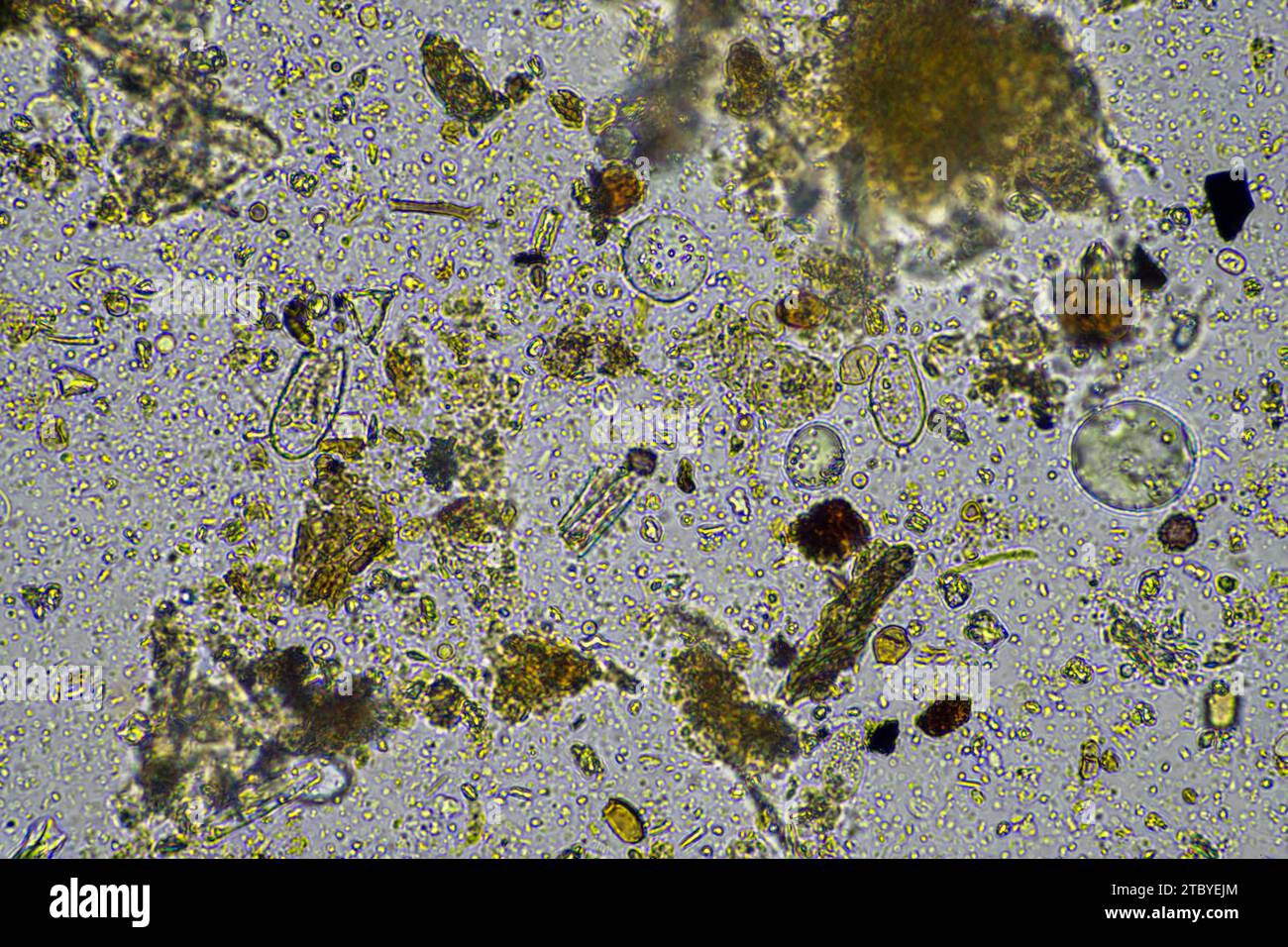 soil microbes under the microscope. microorganisms with fungus in ...