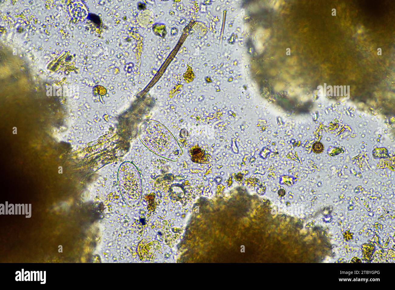 microscopic fungus and microorganisms in a sample in australia Stock Photo