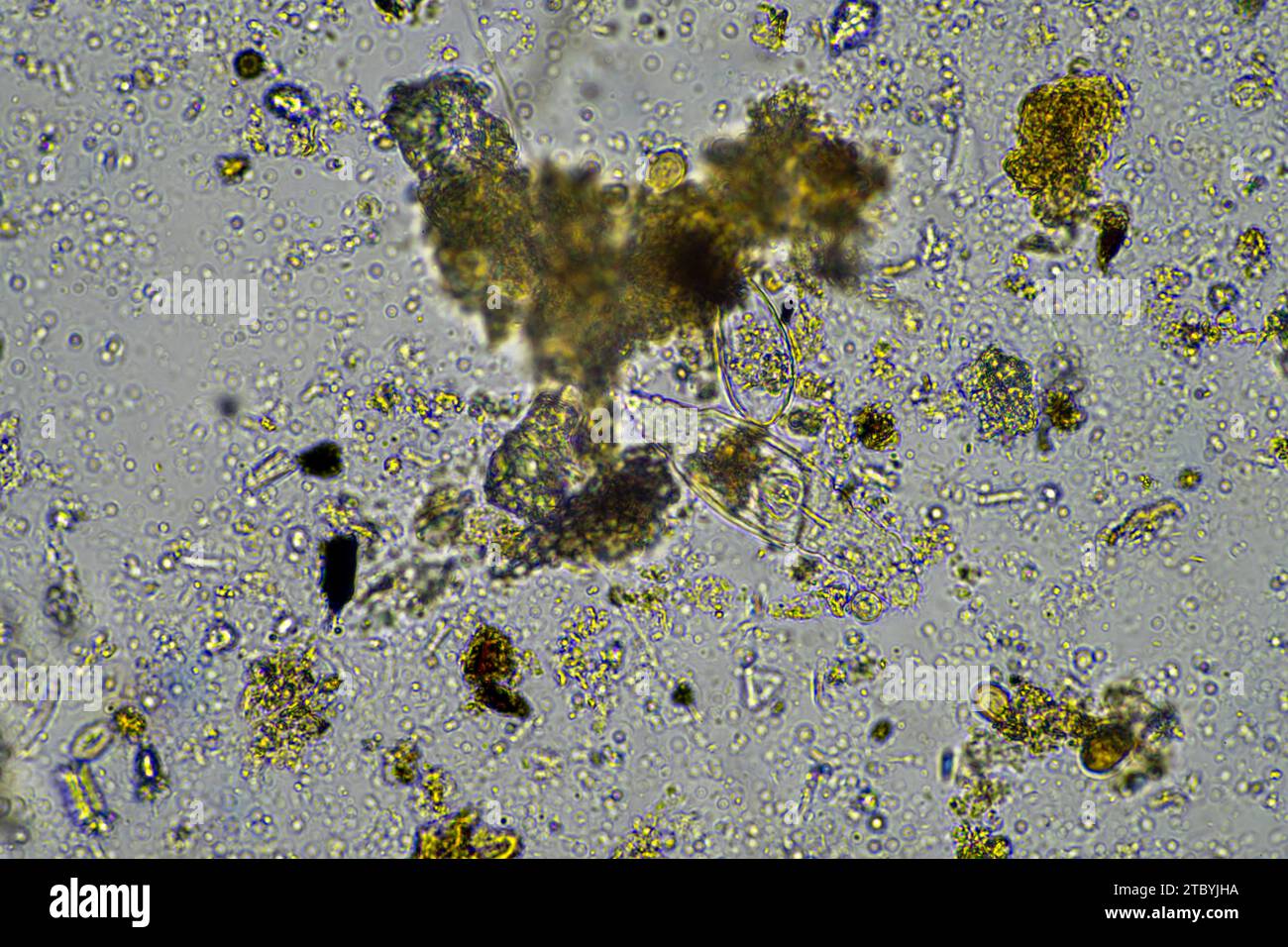 soil microbes under the microscope. microorganisms with fungus in compost Stock Photo